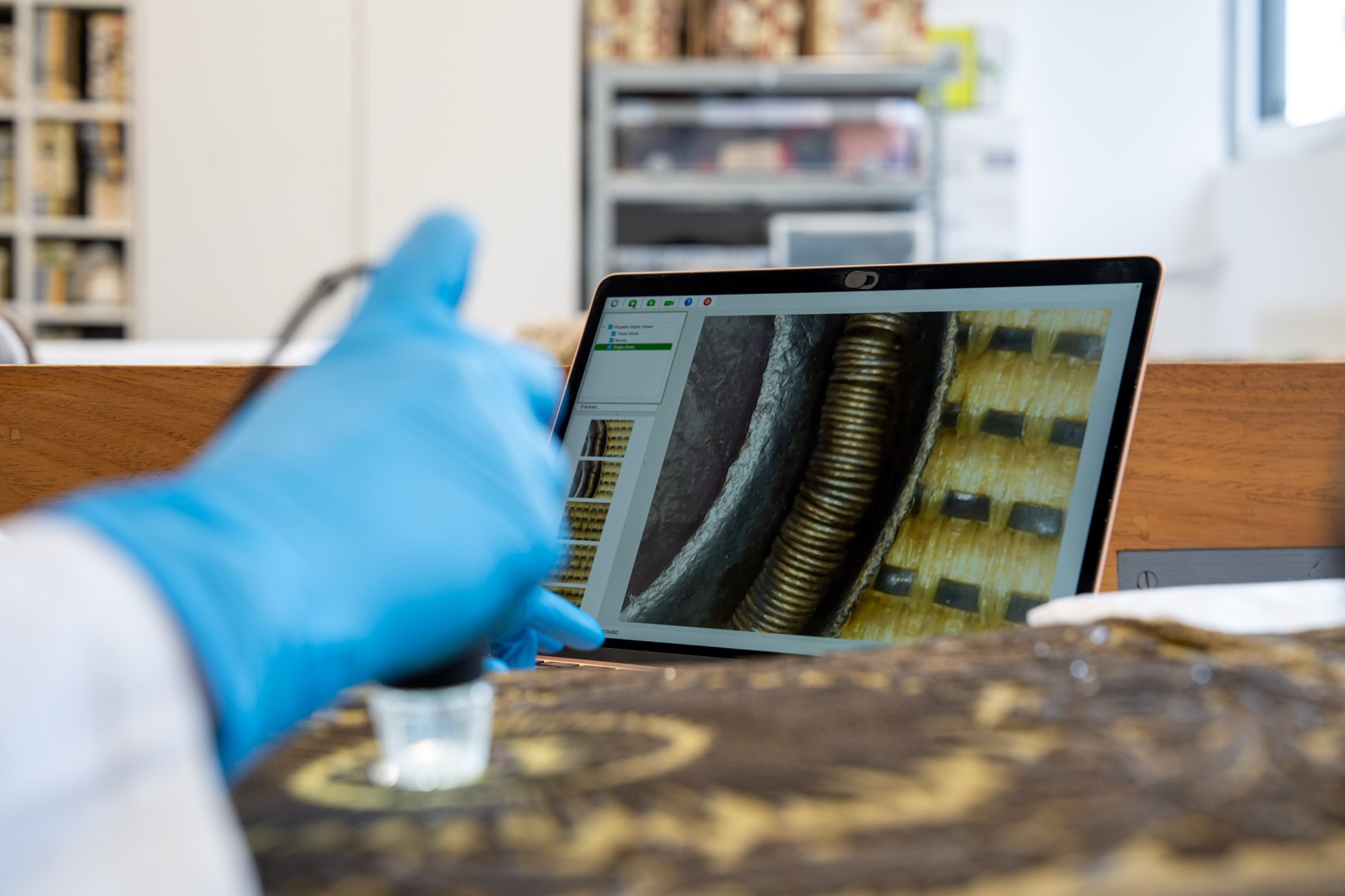 Diagnostic sous microscope numérique